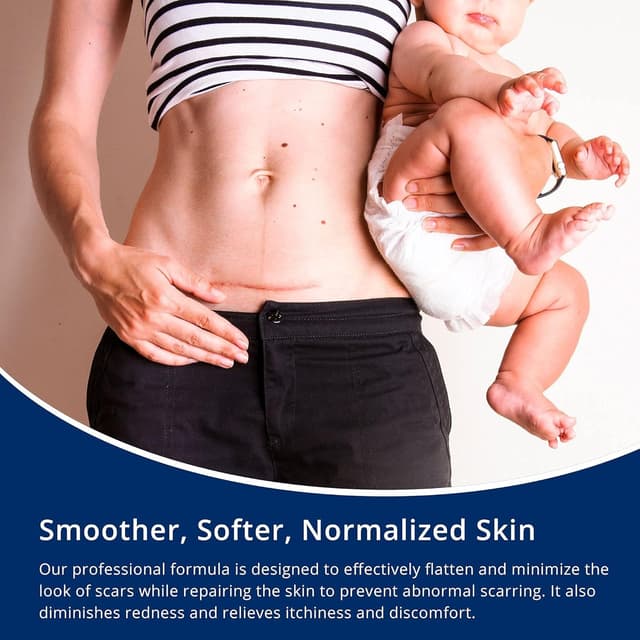 Detalle de 100% Silicone Scar Gel 2-Pack (2 x 1.06oz) for Surgical Scars, C-Section, Acne Marks, Keloids, Burns & Stretch Marks