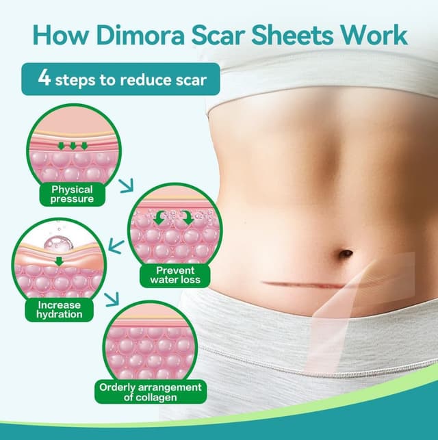 Detalle de Dimora Medical Grade Silicone Scar Sheets (4cm x 3m) for waterproof scar treatment