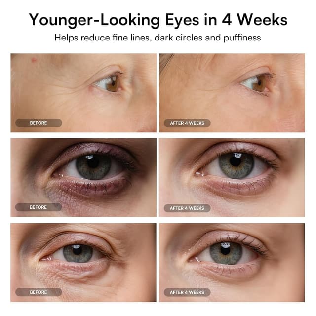 Detalle de INIA Red Light Therapy Eye Mask 96 LEDs