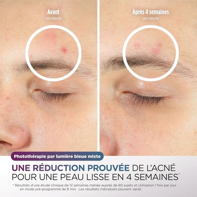 Thumbnail 5 de Shark CryoGlow Masque LED