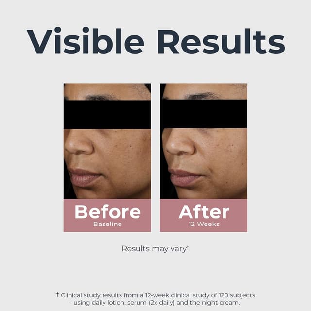 Detalle de Eucerin Radiant Tone Dual Serum for Dark Spots (1 fl oz)