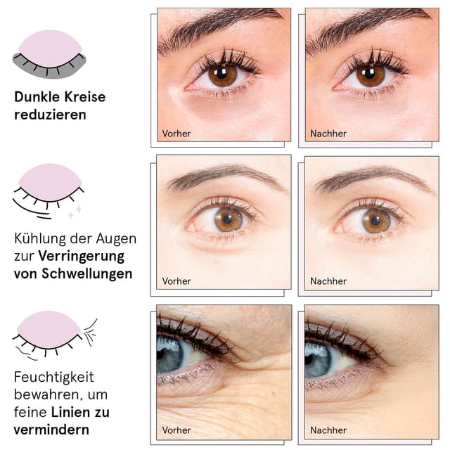 Detalle de grace & stella Augenpads gegen Augenringe, Tränensäcke & Falten (24 Paare, blau)