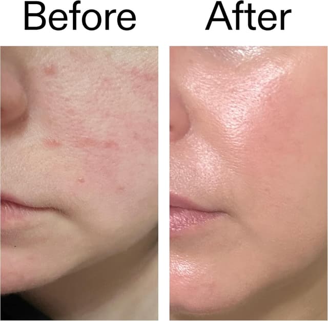 Thumbnail 6 de The INKEY List Exosome Hydro-Glow complesso viso