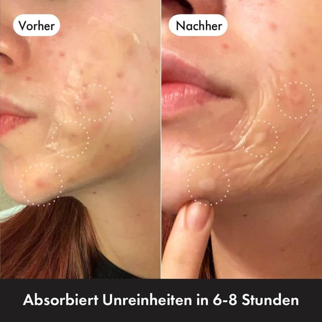 Detalle 1 de Hero Cosmetics Mighty Patch Surface 60×25 mm 🩹