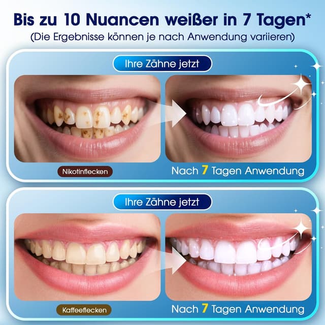 Thumbnail 1 de Zahnaufhellungsset LED 35% PAP – 3 Gel-Stifte