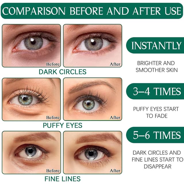 Detalle de Augenpads mit Kollagen, Aloe Vera & Hyaluronsäure – 60 Eye Pads gegen Augenringe, Schwellungen & Falten (grün)