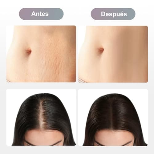 Thumbnail 5 de Dr Pen Ultima M8, 20 aiguilles 36 broches ⚙