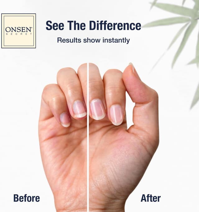 Thumbnail 1 de Onsen Secret Nail Reboot Cuticle Oil Kit 1pk