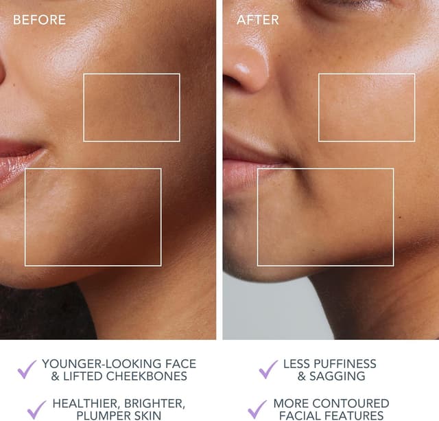 Thumbnail 4 de FOREO Bear 2 Go massaggiatore viso lifting con microcorrenti, formato viaggio Lavender