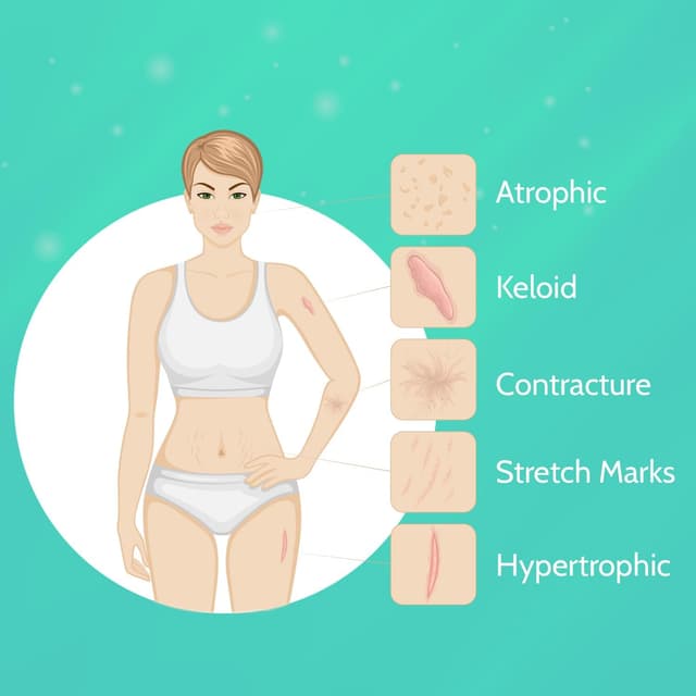 Detalle 2 de Scar Gel Narbencreme – Pflegelösung für frische sowie alte Narben