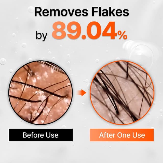 Thumbnail 4 de lilyeve GROWTURN Hair Growth Serum 38