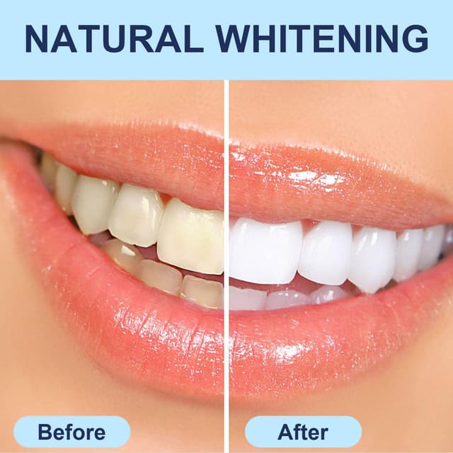 Thumbnail 4 de Teeth Whitening Strips – 28 Strips (14-Day) 📄