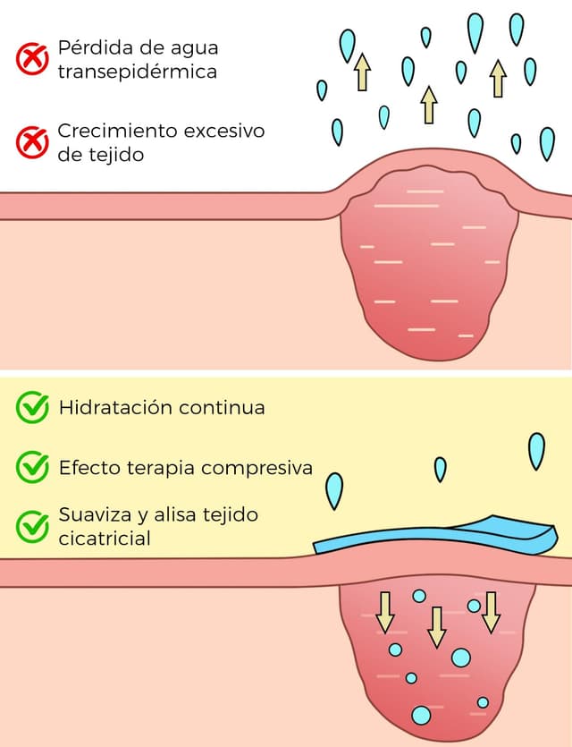 Thumbnail 3 de Parches de silicona 4x150 cm para cicatrices