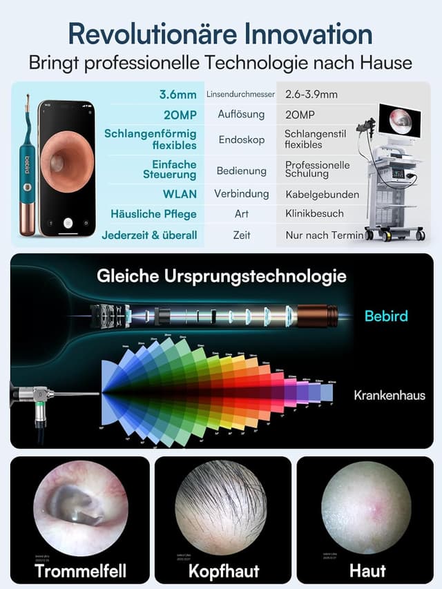 Detalle 2 de BEBIRD EarSight Ultra 5G Ohrreiniger