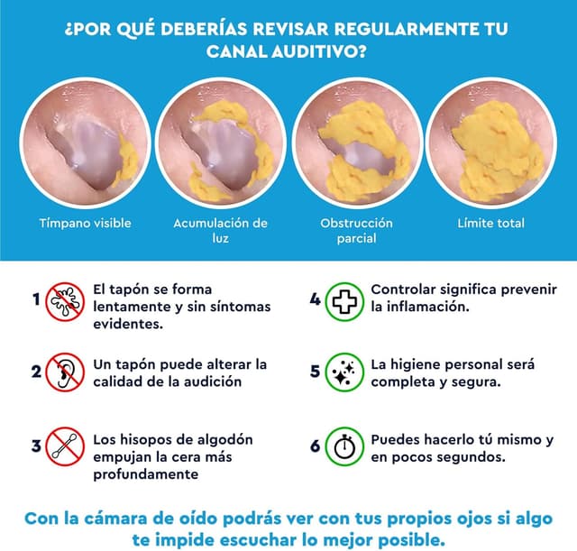 Detalle 2 de Otoscopio Limpiador de Oídos con Cámara 3,6mm 1920p WiFi