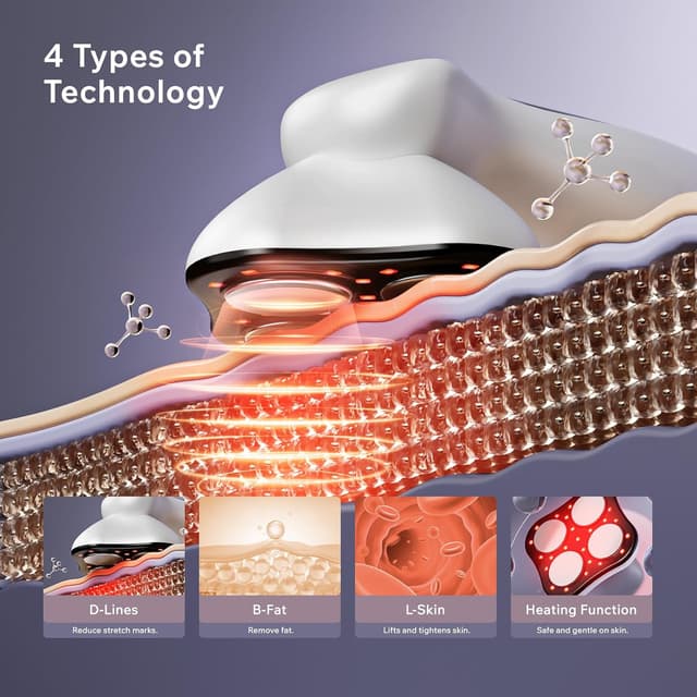 Detalle de Oranmagic Body Sculpting Machine – Heating & Microcurrent cellulite and stretch mark massager (White)