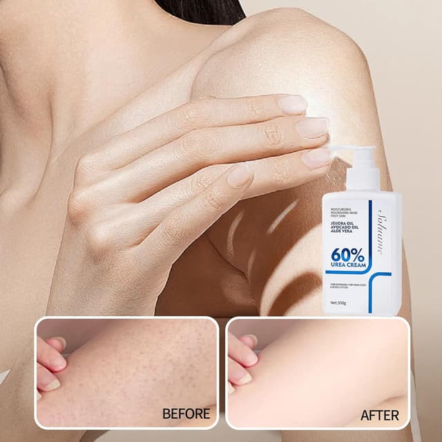 Detalle de Soluame Urea Bodylotion mit 60% Urea Plus 2% Salicylsäure – schnell einziehende Pflege für trockene Haut (300 g)