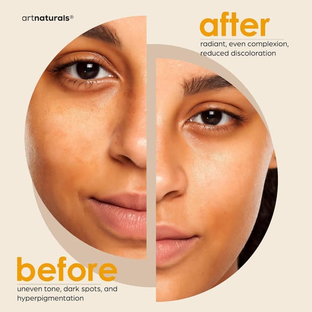 Detalle 2 de Kojic acid soap dark spot removal 2 pack