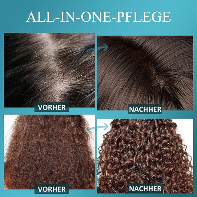 Detalle 1 de SHVYOG Kopfhautpeeling mit 250 g