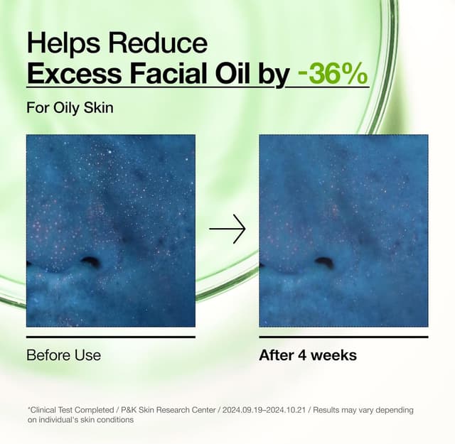 Thumbnail 5 de Anua Azelaic 10 Hyaluron Serum