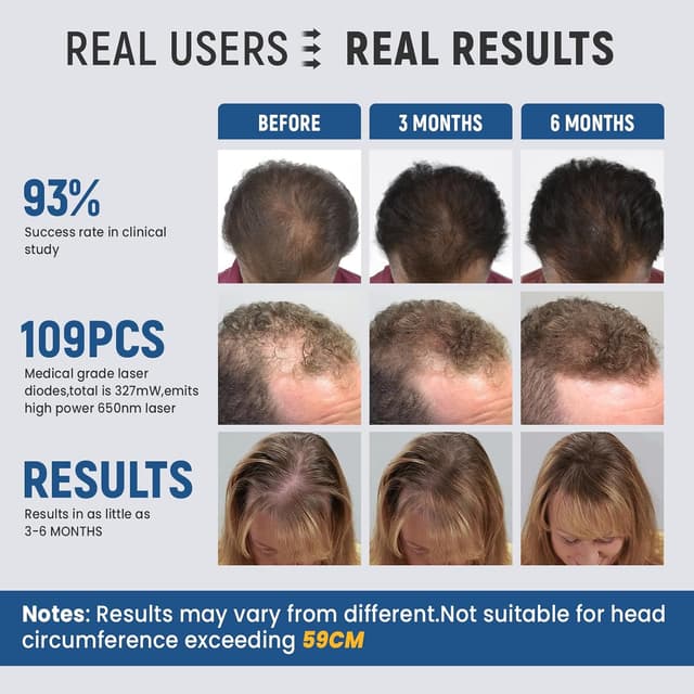 Thumbnail 1 de iKeener lllt Laser Helm 109 Dioden 3800 mAh