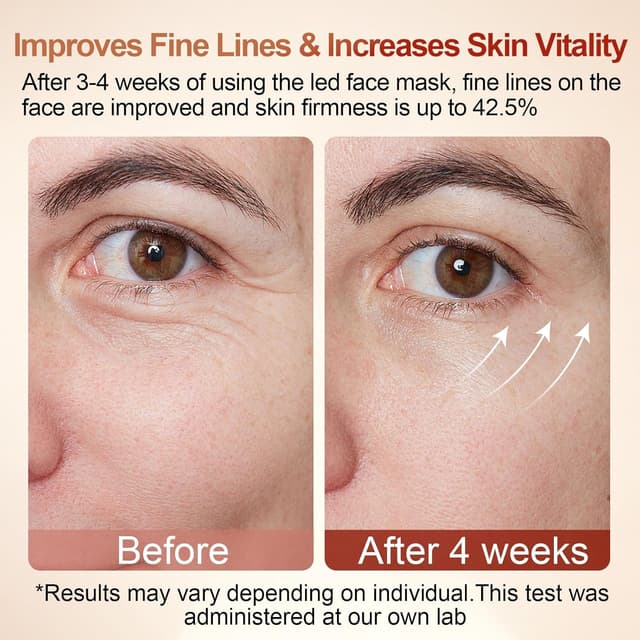 Thumbnail 4 de Rkdely Masque LED visage 4 couleurs sans fil, réduction acné