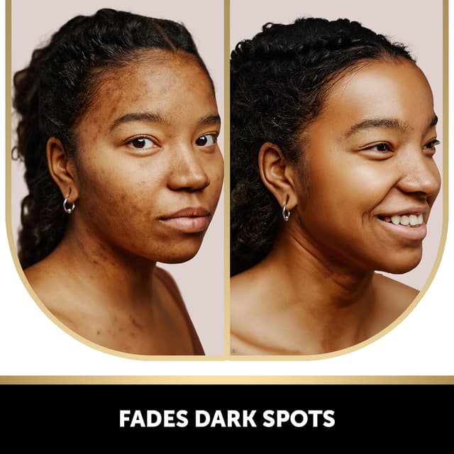 Detalle 2 de Valitic Kojic Acid Soap Bars 4 Pack