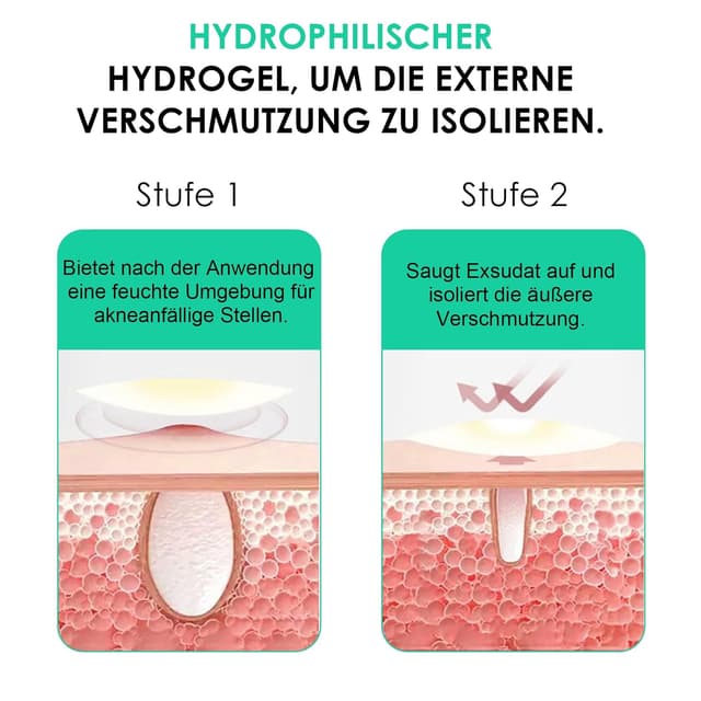 Thumbnail 4 de Home Holic Pimple Patches 264 Stück