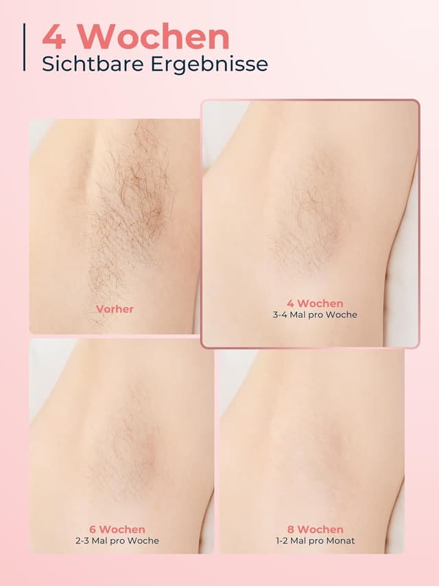 Thumbnail 5 de 21J IPL Haarentfernung Rose 8°C Kühlung