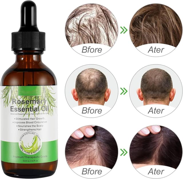 Thumbnail 3 de Aceite de Romero Crecimiento Cabello 60ml