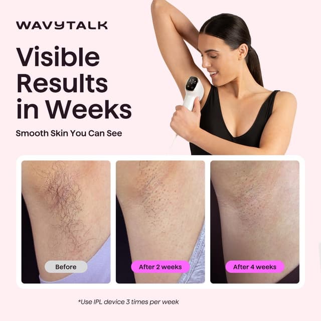 Detalle 2 de wavytalk IPL Hair Removal Device (Bare It) for Face, Body & Bikini — Corded, White