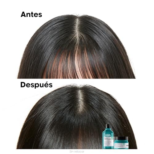 Thumbnail 5 de L’Oréal Professionnel Scalp Advanced champú antigrasa 500 ml