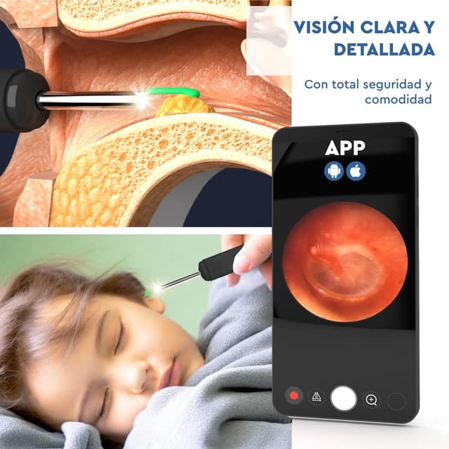 Thumbnail 2 de Otoscopio Limpiador de Oídos con Cámara 3,6mm 1920p WiFi