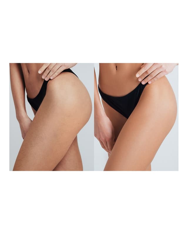 Detalle de FOREO 2 Pro Max, 90% de vello