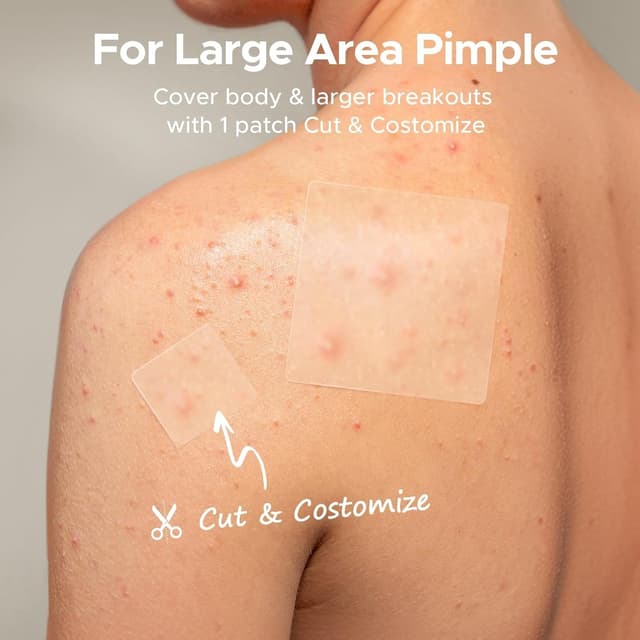 Thumbnail 2 de TKTK Large Pimple Patches 60mm XL
