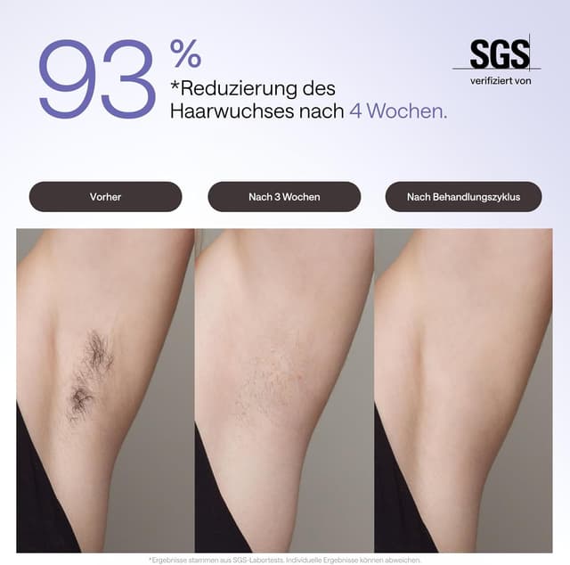 Detalle de Ulike Air 3 IPL Haarentfernung 90/min 💄