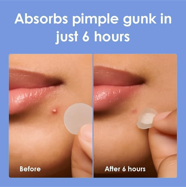 Thumbnail 6 de Hydrokolloid Pimple Patches 1250 Stück