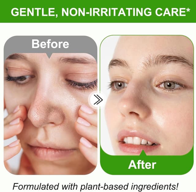 Thumbnail 4 de Eliminador de puntos negros nariz rostro Arcilla Blanca Amazónica