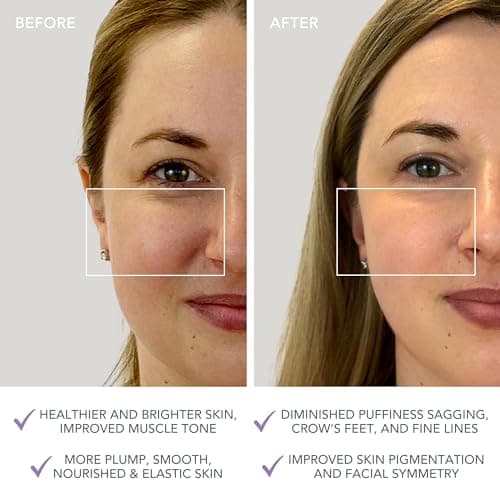 Thumbnail 4 de FOREO BEAR mini Masajeador Facial