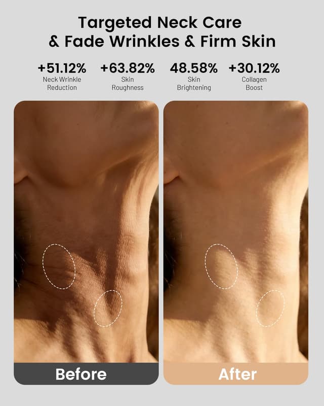 Detalle de Aokitec 4D LED Maske für Gesicht & Hals mit 7 Farben, 850 nm NIR und IPX7 (kabelloses Home-Spa)