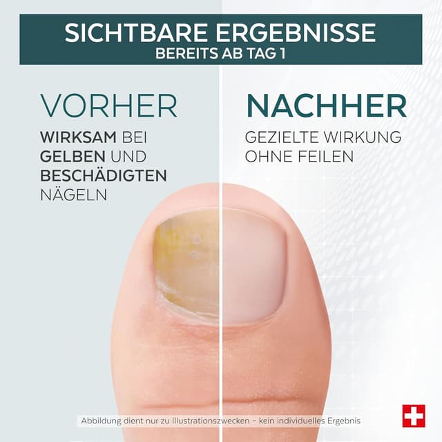 Detalle de PODERM Tea Tree Nagel-Repair-Serum 6 ml (4-in-1 Pflege) – Swiss Made