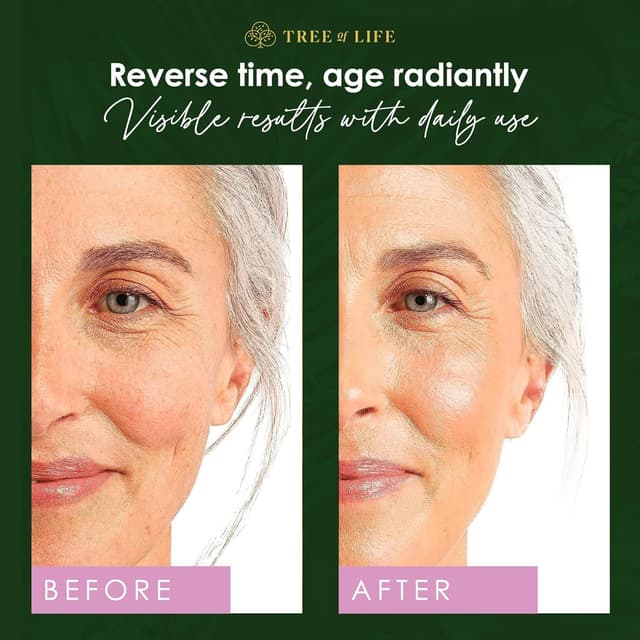 Thumbnail 2 de Tree of Life Beauty Retinol Serum 2 fl oz 💧