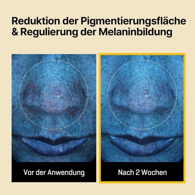 Detalle de SOME BY MI Yuja Niacin Anti Blemish Daily Mask – maschera viso giornaliera con niacinamide (30 fogli)