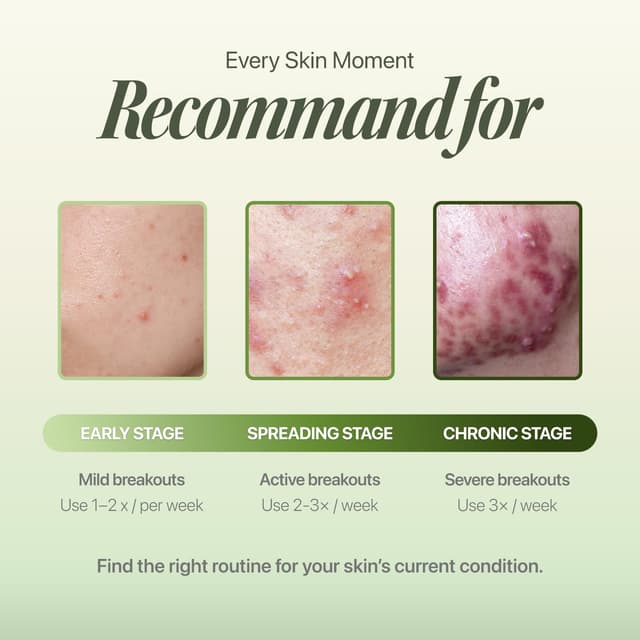 Detalle 2 de EIOM Trouble Patch Mask Full Face Hydrocolloid Pimple Patch & Face Mask (20ml x 4)