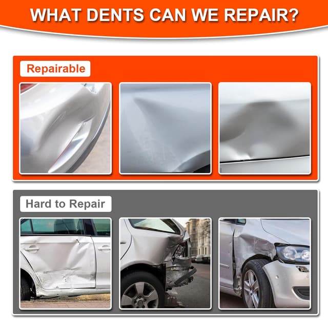 Thumbnail 5 de Ventosa Carrocería kit 15 kg