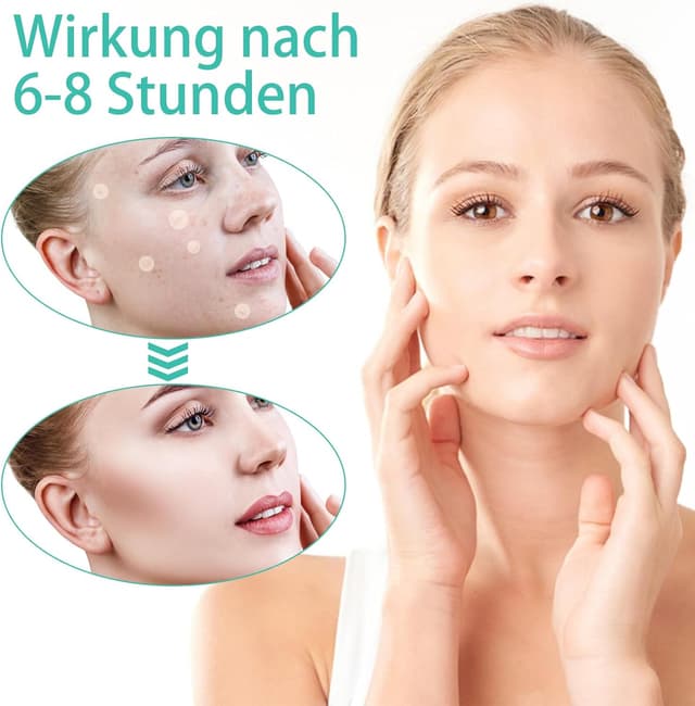 Detalle de Patch Brufoli Idrocolloidali invisibili giorno e notte con Tea Tree Oil e Acido Salicilico, 200 cerotti