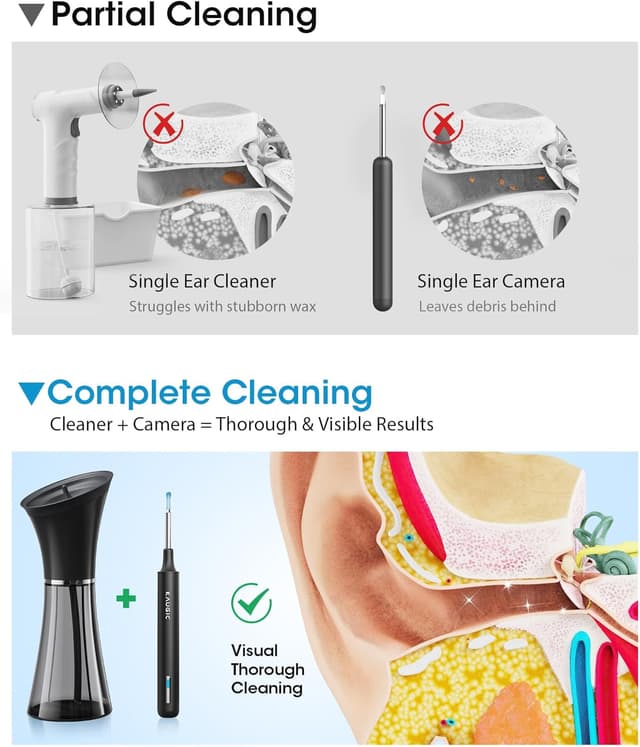Detalle de KAUGIC Ear Wax Removal Kit with Camera — electric ear cleaner with visual inspection and gentle irrigation