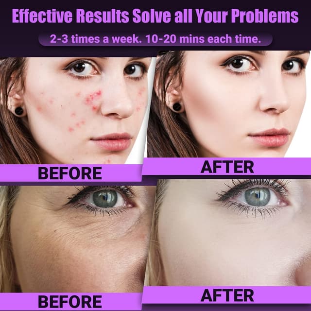 Detalle 2 de UUPAS 6 in 1 ad alta frequenza