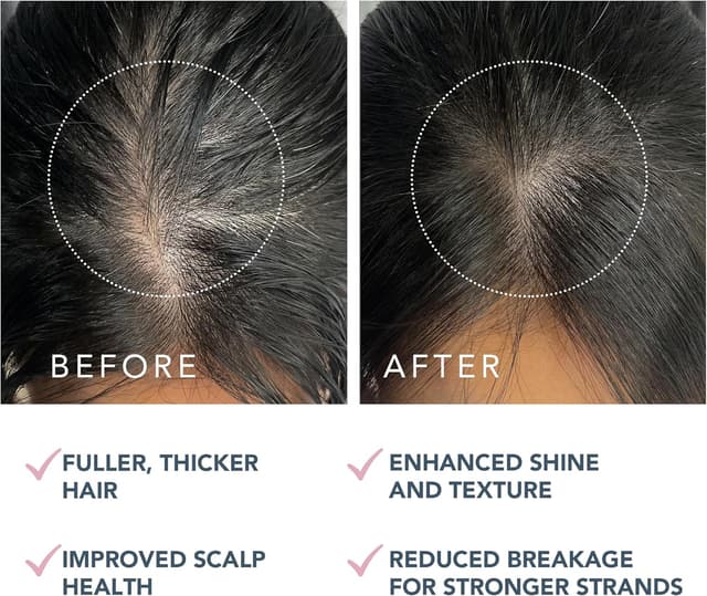 Detalle 1 de FOREO LUNA siero doppio peptide per capelli