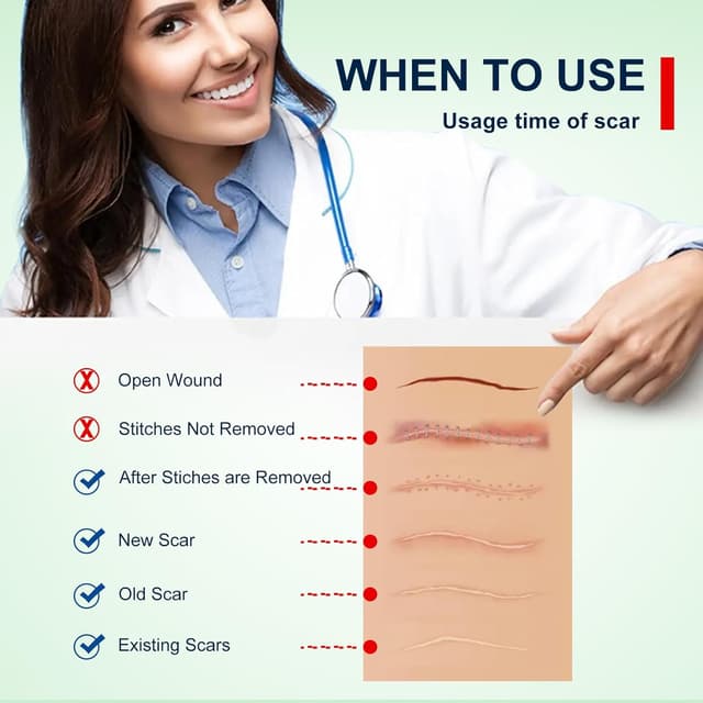 Thumbnail 4 de Silicone Scar Sheets 1.6" x 120" Roll